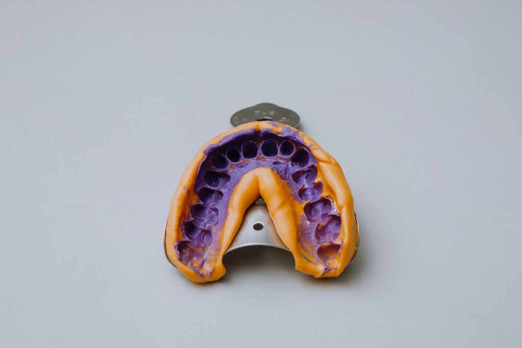 Featured image untuk artikel kapan harus ganti tambal gigi